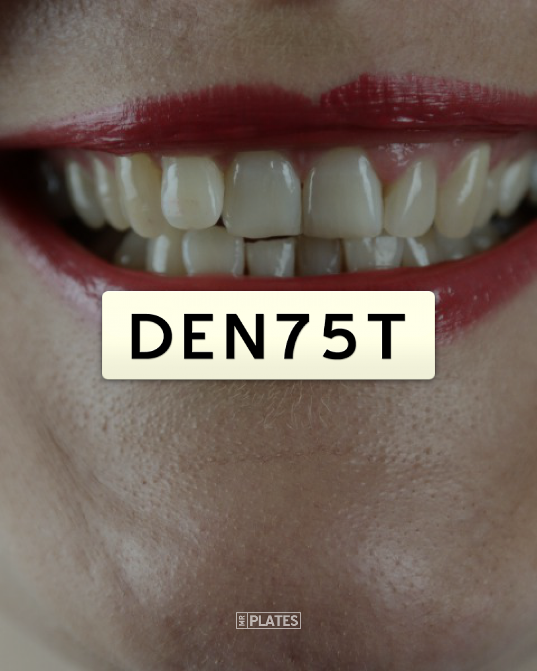 DEN75T (DENTIST) Number Plates For Sale, NSW MrPlates